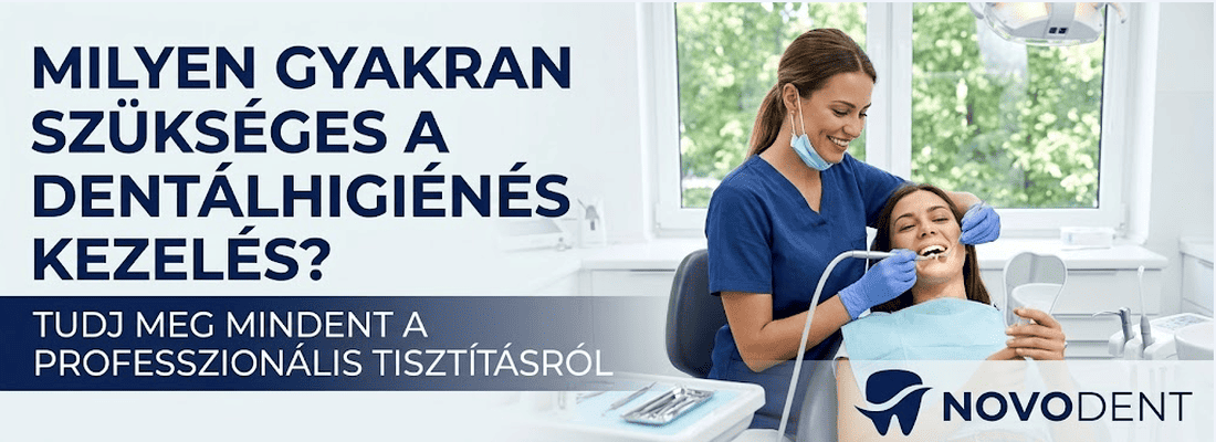 Milyen gyakran szükséges a professzionális dentálhigiénés kezelés - Novodent fogászati tisztítás